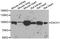 Dachshund homolog 1 antibody, STJ28975, St John