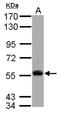 Tyrosine-protein kinase Tec antibody, NBP2-20591, Novus Biologicals, Western Blot image 