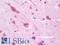 Cytoplasmic Linker Associated Protein 1 antibody, LS-B9742, Lifespan Biosciences, Immunohistochemistry paraffin image 