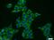 VPS52 Subunit Of GARP Complex antibody, 11662-2-AP, Proteintech Group, Immunofluorescence image 