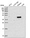 Ring Finger Protein 135 antibody, HPA052404, Atlas Antibodies, Western Blot image 