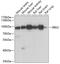 Bardet-Biedl syndrome 2 protein antibody, A03941, Boster Biological Technology, Western Blot image 
