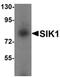 Msk antibody, orb75607, Biorbyt, Western Blot image 