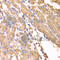 SUFU Negative Regulator Of Hedgehog Signaling antibody, A6757, ABclonal Technology, Immunohistochemistry paraffin image 