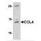 C-C Motif Chemokine Ligand 4 antibody, MBS153358, MyBioSource, Western Blot image 