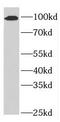 Nuclear pore complex protein Nup98-Nup96 antibody, FNab05932, FineTest, Western Blot image 