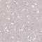 Complement C3b/C4b Receptor 1 (Knops Blood Group) antibody, HPA042455, Atlas Antibodies, Immunohistochemistry frozen image 