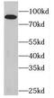 Plakophilin 3 antibody, FNab06518, FineTest, Western Blot image 