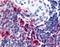 ATRN antibody, LS-A8290, Lifespan Biosciences, Immunohistochemistry paraffin image 