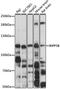 Inositol Polyphosphate-5-Phosphatase B antibody, LS-C746836, Lifespan Biosciences, Western Blot image 