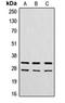 39S ribosomal protein L12, mitochondrial antibody, orb214530, Biorbyt, Western Blot image 