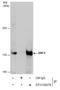 hCAP-E antibody, GTX130078, GeneTex, Immunoprecipitation image 