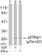Cyclin-dependent kinase inhibitor 1B antibody, 79-196, ProSci, Western Blot image 