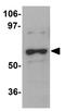 DDB1 And CUL4 Associated Factor 12 antibody, GTX85189, GeneTex, Western Blot image 