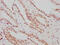 Aryl hydrocarbon receptor nuclear translocator antibody, CSB-RA002121A0HU, Cusabio, Immunohistochemistry paraffin image 