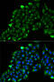 Acyl-CoA Dehydrogenase Short Chain antibody, 22-798, ProSci, Immunofluorescence image 
