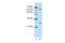 Nudix Hydrolase 21 antibody, ARP40695_T100, Aviva Systems Biology, Western Blot image 