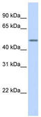 Keratin 16 antibody, TA346409, Origene, Western Blot image 