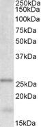 Rho-GDI beta antibody, 42-819, ProSci, Western Blot image 
