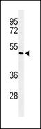 SMAD Family Member 7 antibody, TA324865, Origene, Western Blot image 
