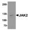 Janus Kinase 2 antibody, TA349137, Origene, Western Blot image 
