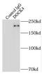 Dedicator Of Cytokinesis 4 antibody, FNab02495, FineTest, Immunoprecipitation image 