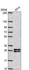 F-Box Protein 36 antibody, PA5-65825, Invitrogen Antibodies, Western Blot image 