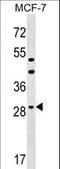 Dehydrogenase/Reductase 11 antibody, LS-C159456, Lifespan Biosciences, Western Blot image 