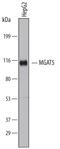 Alpha-1,6-Mannosylglycoprotein 6-Beta-N-Acetylglucosaminyltransferase antibody, MAB5469, R&D Systems, Western Blot image 