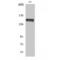 Phospholipase C Gamma 1 antibody, LS-C380827, Lifespan Biosciences, Western Blot image 