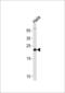 PRDX2 antibody, 61-603, ProSci, Western Blot image 