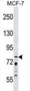 Zinc finger protein 828 antibody, abx029800, Abbexa, Western Blot image 