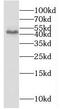Kazrin antibody, FNab04473, FineTest, Western Blot image 
