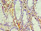 Galectin 1 antibody, A57097-100, Epigentek, Immunohistochemistry paraffin image 