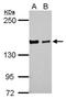 DAZ Interacting Zinc Finger Protein 3 antibody, NBP2-16248, Novus Biologicals, Western Blot image 