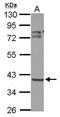3-Oxoacyl-ACP Synthase, Mitochondrial antibody, GTX123463, GeneTex, Western Blot image 