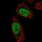 Abhydrolase Domain Containing 16B antibody, HPA059272, Atlas Antibodies, Immunofluorescence image 