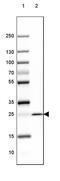 Myelin Oligodendrocyte Glycoprotein antibody, MA5-24644, Invitrogen Antibodies, Western Blot image 