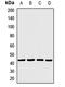 Calcium/Calmodulin Dependent Protein Kinase ID antibody, orb412626, Biorbyt, Western Blot image 