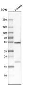 Immunoglobulin Superfamily Containing Leucine Rich Repeat antibody, HPA050811, Atlas Antibodies, Western Blot image 