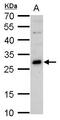 GS Homeobox 2 antibody, PA5-35887, Invitrogen Antibodies, Western Blot image 