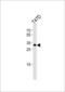 Inhibitor Of Growth Family Member 4 antibody, LS-B14767, Lifespan Biosciences, Western Blot image 
