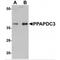 Phospholipid Phosphatase 7 (Inactive) antibody, MBS151216, MyBioSource, Western Blot image 