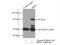 Bardet-Biedl Syndrome 1 antibody, 21118-1-AP, Proteintech Group, Immunoprecipitation image 