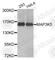 Mitogen-Activated Protein Kinase Kinase Kinase 5 antibody, A6274, ABclonal Technology, Western Blot image 