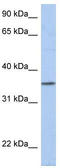Proline Rich 18 antibody, TA333442, Origene, Western Blot image 