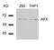 Forkhead Box O4 antibody, 79-343, ProSci, Western Blot image 