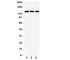 ATXN2 antibody, R31210, NSJ Bioreagents, Western Blot image 