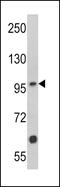 Muscle, skeletal receptor tyrosine-protein kinase antibody, 63-113, ProSci, Western Blot image 