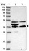 Fasciculation And Elongation Protein Zeta 2 antibody, PA5-57491, Invitrogen Antibodies, Western Blot image 